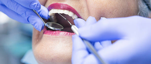 Best Emergency Tooth Extraction in Terrebonne, OR
